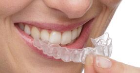 invisalign-for-adults